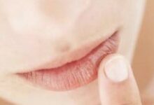 چگونه ترک و خشکی لب در زمستان ,را درمان کنیم؟ (2 نکته مهم)
