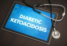 کتواسیدوز دیابتی (DKA) چیست؟ آیا این عارضه قابل درمان است؟ (2 نکته مهم)