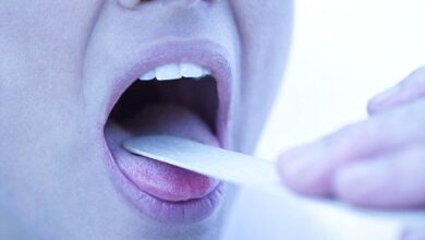 گلودرد چرکی دارید؟ با این روش ها از سرایت آن جلوگیری کنید (2 نکته مهم)