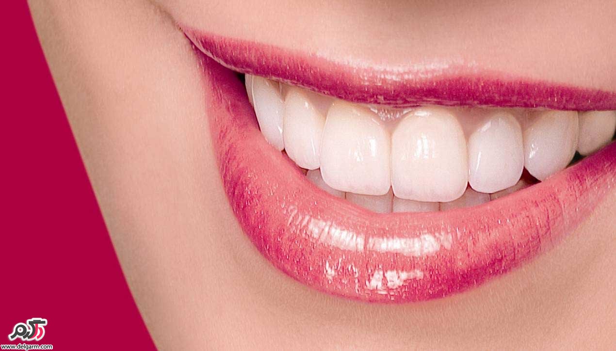 تقویت لثه؛گیاهان دارویی مناسب برای تقویت لثه و دندان ها (2 نکته مهم)