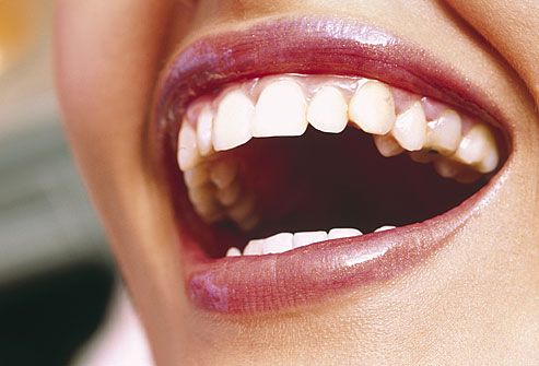 دندان های سفید و دهانی خوشبو با راهکارهای پیش رو (2 نکته مهم)