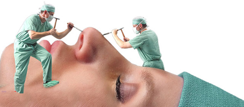 همه چیز درباره عمل زیبایی بینی (2 نکته مهم)
