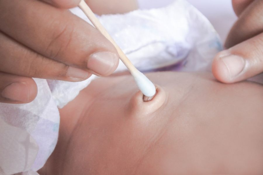 چگونه ناف را تمیز کنیم ؟ آموزش مرحله به مرحله تمیز کردن ناف (2 نکته مهم)