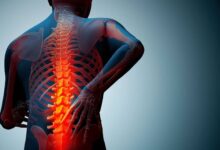 داروهای گیاهی پوکی استخوان :‌ درمان قطعی پوکی استخوان در طب سنتی (2 نکته مهم)