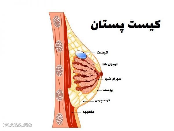 عوارض نوشیدن بیش از حد قهوه