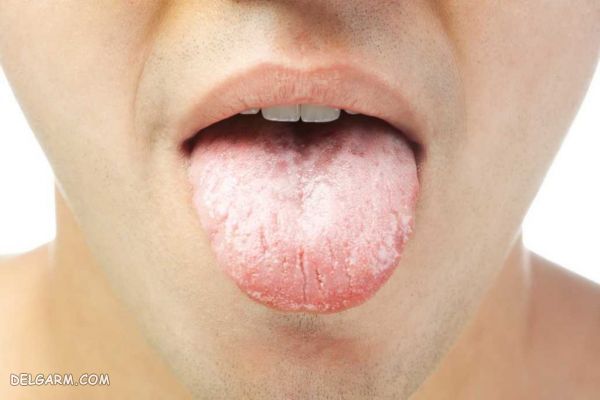 عوارض نوشیدن بیش از حد قهوه