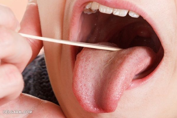 علائم حساسیت به موز
