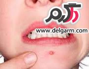 پوست،عید،جوان،چین وچروک،خوش فرم،جوش،لکه قهوه‌ای