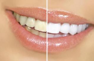 14 راهکار طب سنتی برای دهان و دندان های شما (2 نکته مهم) 14 راهکار طب سنتی برای دهان و دندان های شما (2 نکته مهم)
