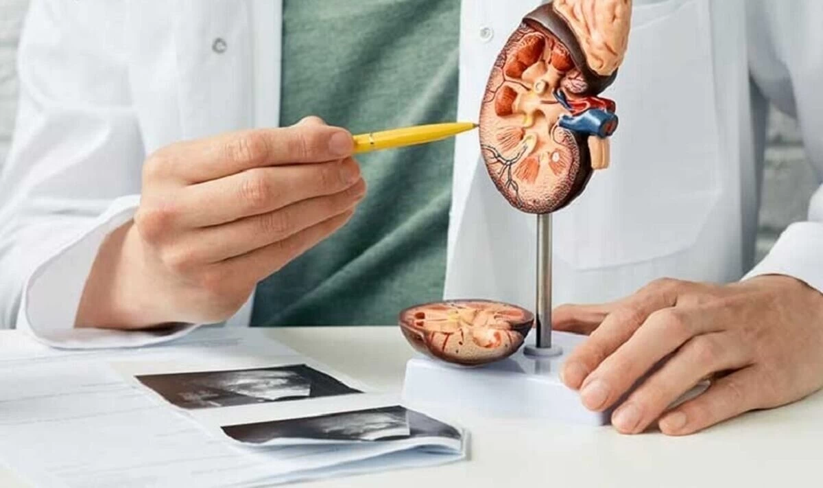 نگاهی بر تاثیر مصرف کلاژن بر سنگ کلیه (2 نکته مهم)