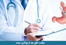 مراقبت های بعد از بوتاکس معده و توصیه های لازم (2 نکته مهم)