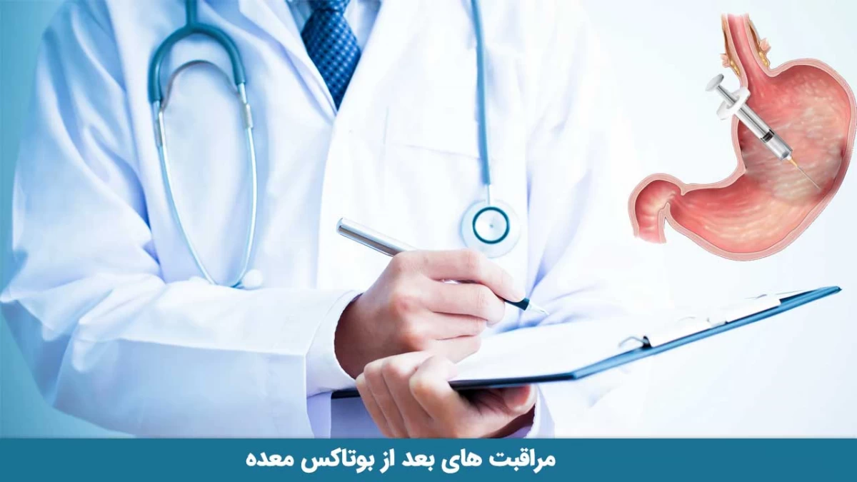 مراقبت های بعد از بوتاکس معده و توصیه های لازم (2 نکته مهم) مراقبت های بعد از بوتاکس معده و توصیه های لازم (2 نکته مهم)