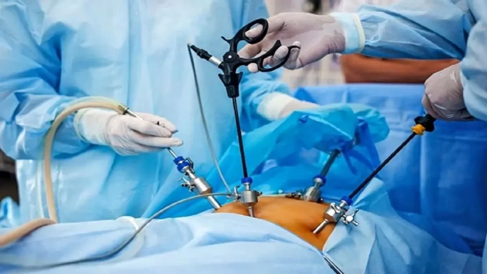 مراقبت های قبل و بعد از لیپوساکشن
