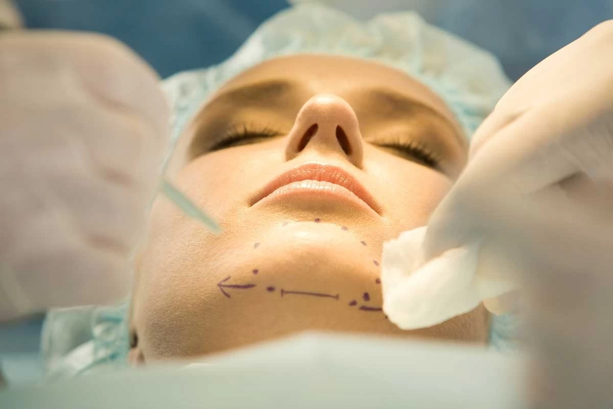 مهمترین مراقبت های بعد از جراحی پروتز چانه (2 نکته مهم) مهمترین مراقبت های بعد از جراحی پروتز چانه (2 نکته مهم)