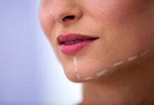 نحوه صحیح خوابیدن بعد از ساکشن غبغب (2 نکته مهم)