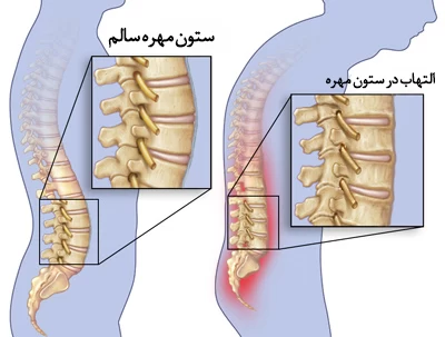 چرا نشستن به مدت طولانی می‌تواند خطرناک باشد