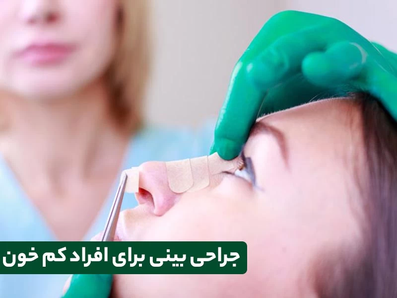 آیا با وجود مشکلات خونی می‌توان عمل بینی انجام داد؟ (2 نکته مهم)