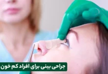 آیا با وجود مشکلات خونی می‌توان عمل بینی انجام داد؟ (2 نکته مهم)