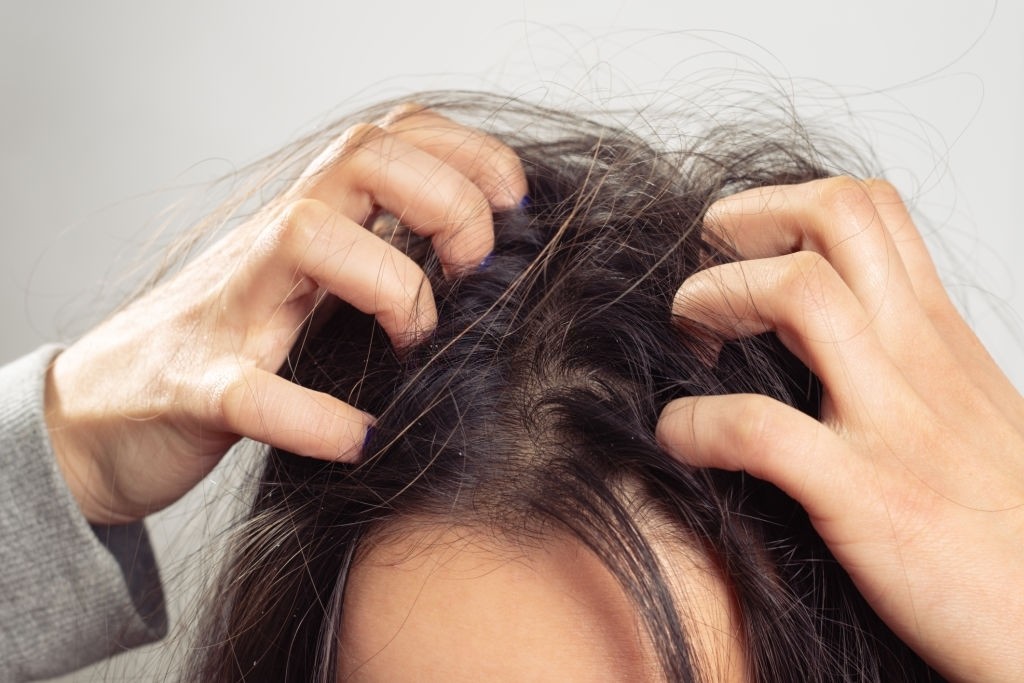 چگونه زخم پوست سر را به راحتی در منزل درمان کنیم؟ (2 نکته مهم)