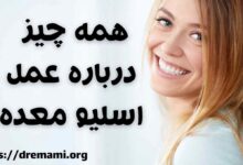 همه چیز درباره اسلیو معده (2 نکته مهم)
