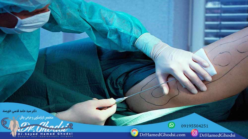 بهترین دکتر برای پیکر تراشی