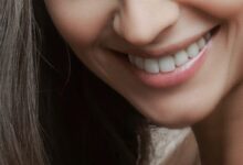 چه کسانی میتوانند ایمپلنت دندان جلو را انجام دهند ؟ (2 نکته مهم)