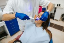 بلیچینگ بهتر است یا جرم گیری دندان ؟ (2 نکته مهم)