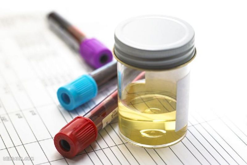 بیماری های منتقله جنسی (STDs)