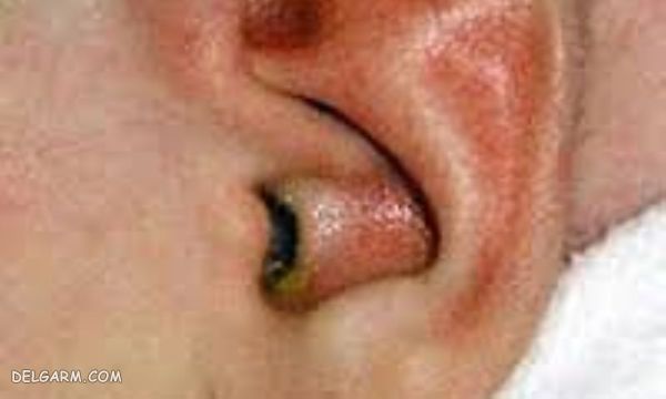 12 علامت بارز ضعف سیستم ایمنی بدن (2 نکته مهم) علائم ضعف سیستم ایمنی