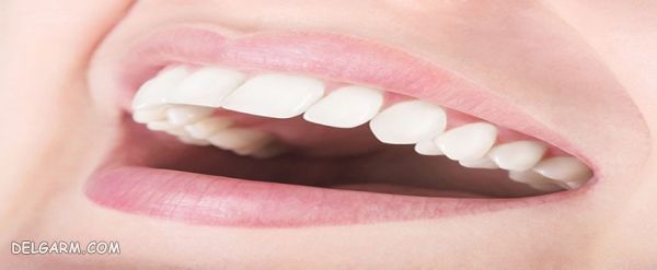 اصلاح طراحی لبخند 