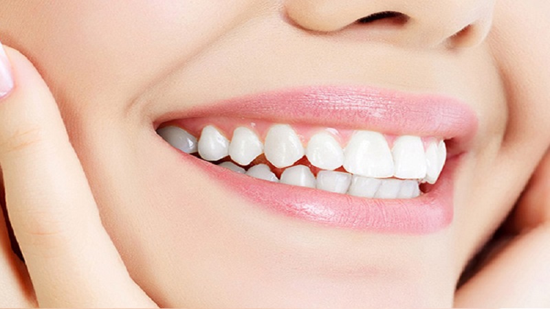 طراحی لبخند به چند روش و چگونه انجام میشود ؟ (2 نکته مهم)