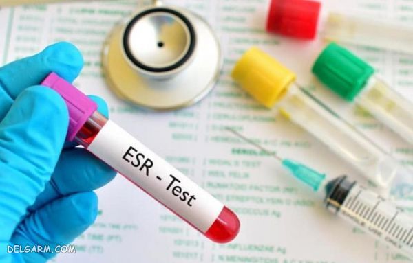 ESR در آزمایش / ESR / محدوده خطر ESR / خطر بالا بودن ESR / عوارض بالا بودن ESR / پایین بودن ESR در آزمایش خون نشانۀ چیست / بالا بودن ESR در آزمایش خون