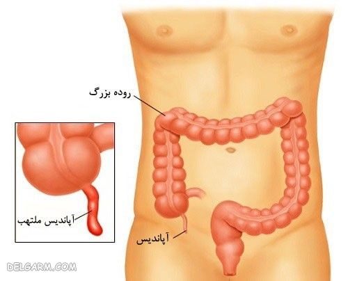 بدون کدام اندام ها باز هم زنده می مانیم ؟