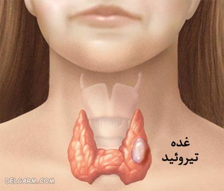 بدون کدام اندام ها باز هم زنده می مانیم ؟