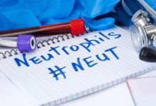 علل و خطرات بالا و پایین شدن Neut (نوتروفیل) در آزمایش خون (2 نکته مهم)