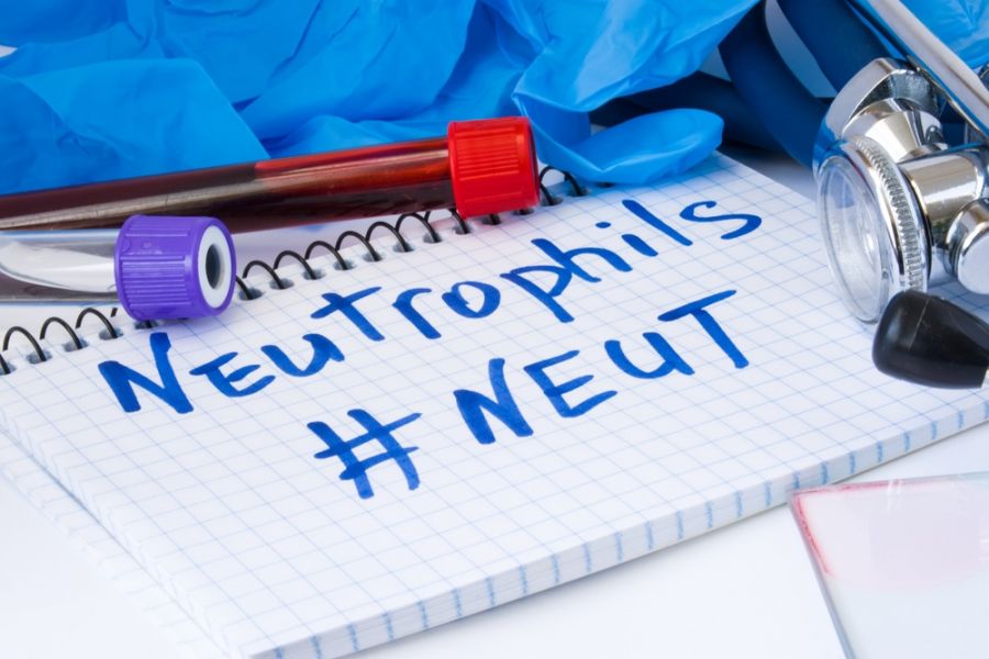 علل و خطرات بالا و پایین شدن Neut (نوتروفیل) در آزمایش خون (2 نکته مهم) علل و خطرات بالا و پایین شدن Neut (نوتروفیل) در آزمایش خون (2 نکته مهم)