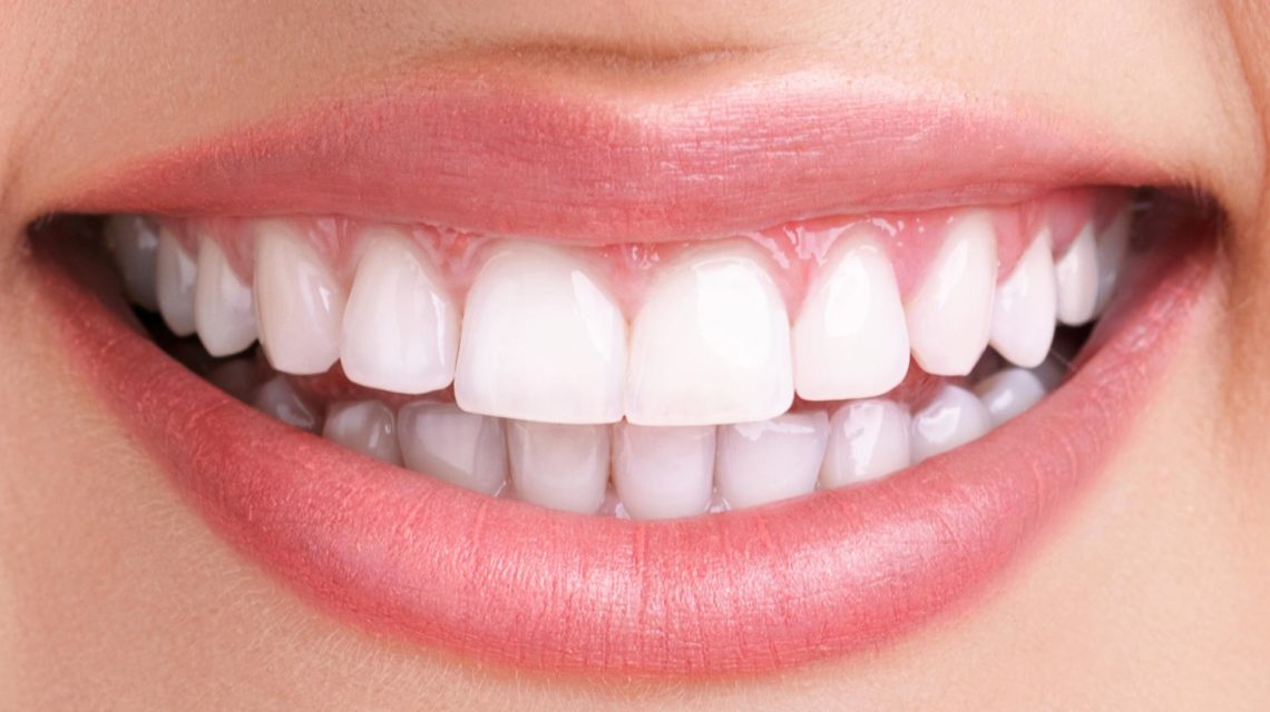 مینی ایمپلنت (mini implant) چیست و چگونه کاشته میشود ؟ (2 نکته مهم)