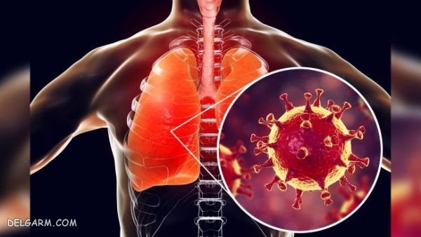 ویروس کرونا و همه گیری آن