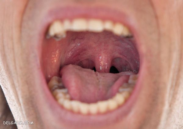 آلرژی به کرفس / آب کرفس برای چه کسانی مضر است ؟