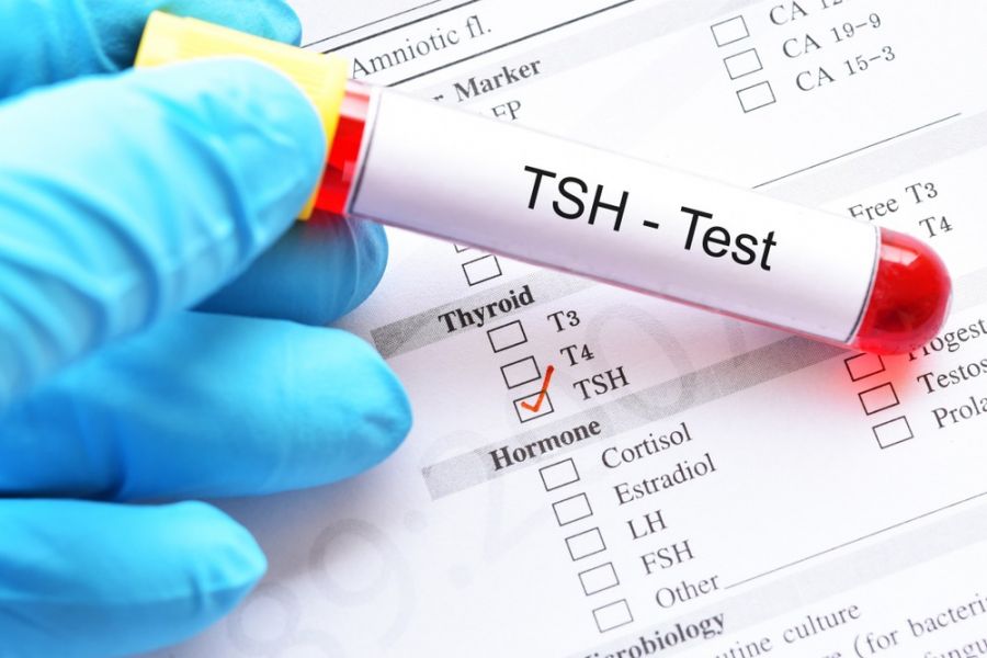 tsh در آزمایش خون نشان دهنده تیروئید پر کار است یا کم کار ؟ (2 نکته مهم)