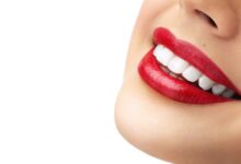 تفاوت بین آمالگام و کامپوزیت در چیست ؟ (2 نکته مهم)