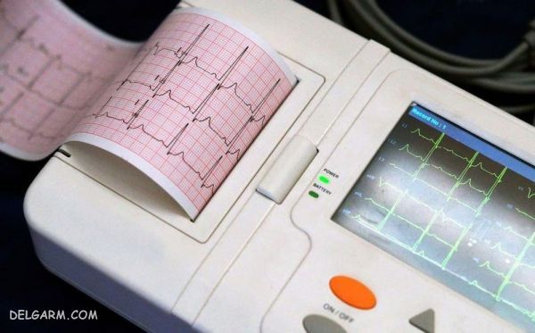 دستگاه نوار قلب (ECG) چیست و چه کاربردی دارد ؟ (2 نکته مهم) همه چیز در مورد الکتروکاردیوگرام یا ECG یا EKD