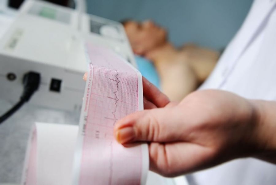 دستگاه نوار قلب (ECG) چیست و چه کاربردی دارد ؟ (2 نکته مهم)