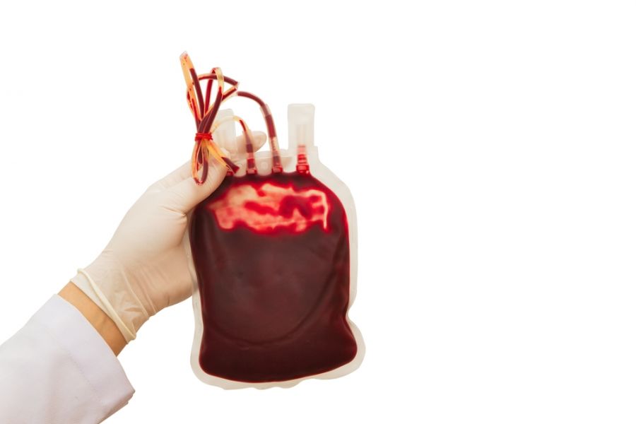 دلایل اصلی بالا رفتن پلاکت خون چیست ؟ (2 نکته مهم) دلایل اصلی بالا رفتن پلاکت خون چیست ؟ (2 نکته مهم)