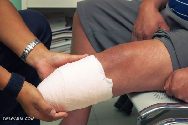 اقدامات لازم پس از قطع عضو