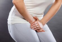 لیزر موهای زائد بیکینی چگونه انجام میشود و چه عوارضی دارد ؟ (2 نکته مهم)