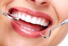 جراحی پیوند لثه | پیوند لثه چند نوع دارد و چگونه انجام میشود ؟ (2 نکته مهم)