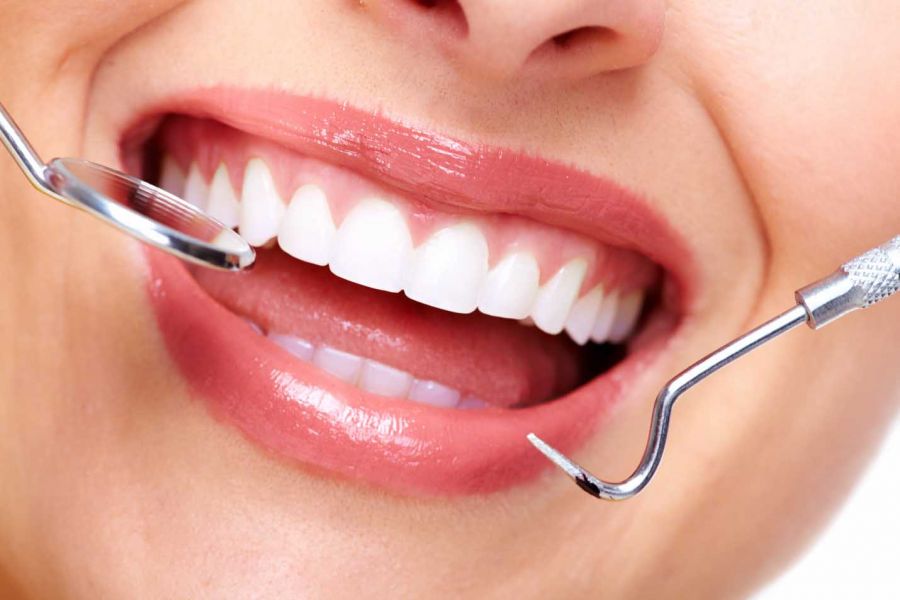 جراحی پیوند لثه | پیوند لثه چند نوع دارد و چگونه انجام میشود ؟ (2 نکته مهم)
