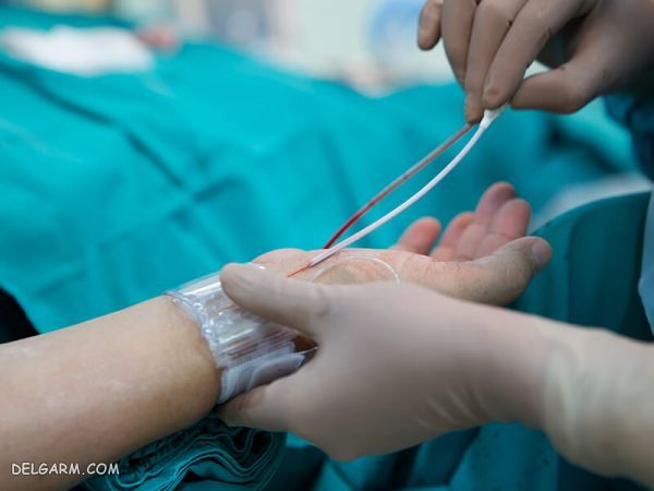فنر قلبی چگونه انجام می‌شود؟