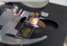 ‏Ova and Parasites‏ در آزمایش مدفوع نشانه چیست ؟ (2 نکته مهم)
